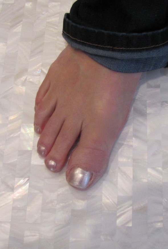 Susie's toes